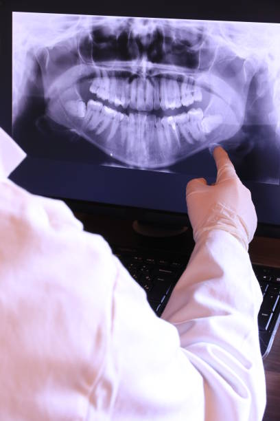 Best Emergency Treatment for Dental Infections or Abscesses in Wolfforth, TX